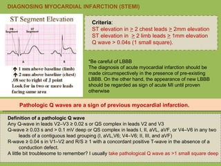 Criteria : ST elevation in  >  2 chest leads  >  2mm elevation ST elevation in   >  2 limb leads  >  1mm elevation Q wave > 0.04s (1 small square). *Be careful of LBBB The diagnosis of acute myocardial infarction should be made circumspectively in the presence of pre-existing LBBB. On the other hand, the appearance of new LBBB should be regarded as sign of acute MI until proven otherwise DIAGNOSING MYOCARDIAL INFARCTION (STEMI) Definition of a pathologic Q wave Any Q-wave in leads V2–V3 ≥ 0.02 s or QS complex in leads V2 and V3 Q-wave ≥ 0.03 s and > 0.1 mV deep or QS complex in leads I, II, aVL, aVF, or V4–V6 in any two leads of a contiguous lead grouping (I, aVL,V6; V4–V6; II, III, and aVF) R-wave ≥ 0.04 s in V1–V2 and R/S ≥ 1 with a concordant positive T-wave in the absence of a conduction defect. A little bit troublesome to remember? I usually  take pathological Q wave as >1 small square deep Pathologic Q waves are a sign of previous myocardial infarction. 