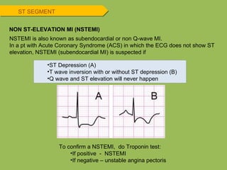 NSTEMI is also known as subendocardial or non Q-wave MI. In a pt with Acute Coronary Syndrome (ACS) in which the ECG does not show ST elevation, NSTEMI (subendocardial MI) is suspected if ST SEGMENT NON ST-ELEVATION MI (NSTEMI) ST Depression (A) T wave inversion with or without ST depression (B) Q wave and ST elevation will never happen To confirm a NSTEMI,  do Troponin test: If positive  -  NSTEMI If negative – unstable angina pectoris 