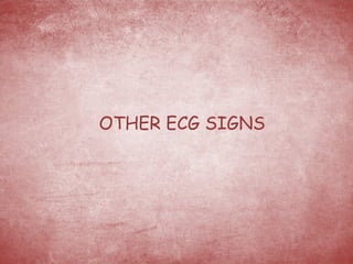 OTHER ECG SIGNS 