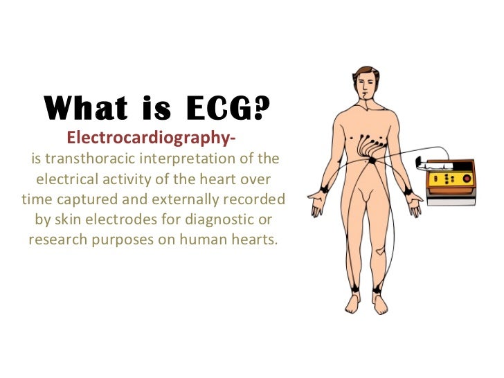 Ecg