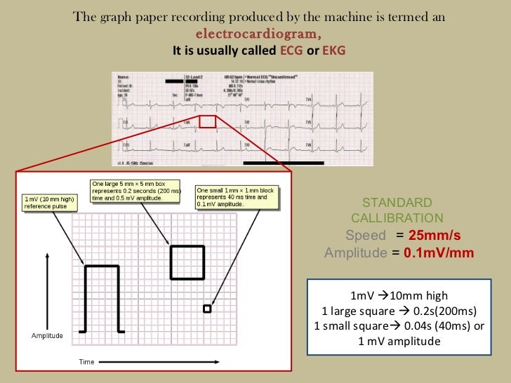 ecg when looking at ecg graph paper one large box represents
