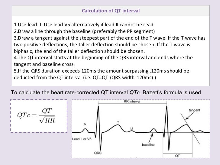 Drawing Lines In Qt : Ecg