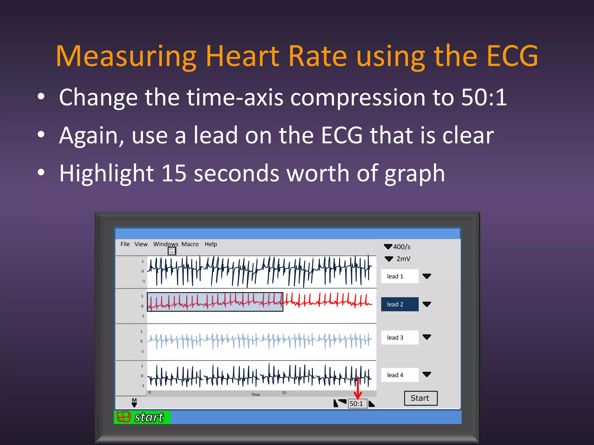 Measuring Heart Rate using the ECG
• Change the time-axis compression to 50:1
• Again, use a lead on the ECG that is clear
• Highlight 15 seconds worth of graph

       File View Windows Macro Help                        400/s
                       Xt
                       2y


              1                                             2mV
              0
                                                         lead 1
              -1


              1

              0                                          lead 2
              -1


              1

              0
                                                         lead 3
              -1


              1

              0                                          lead 4
              -1
                   0                         15
                                      Time
          M                                                        Start
                                                  50:1
 