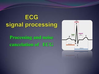 Processing and noise
cancelation of ECG
 