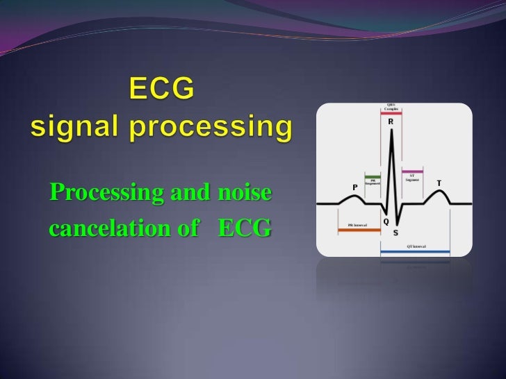 ECG Noise cancelling