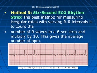 ECG | PPT