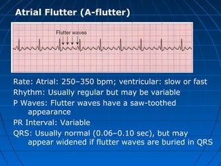 ECG | PPT