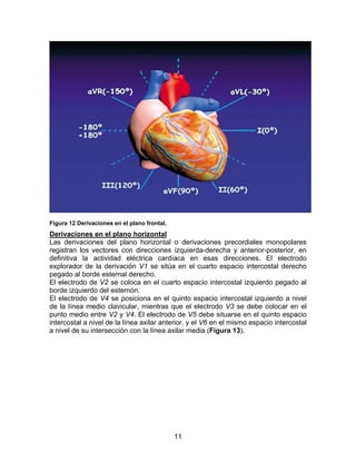 11
Figura 12 Derivaciones en el plano frontal.
Derivaciones en el plano horizontal
Las derivaciones del plano horizontal o derivaciones precordiales monopolares
registran los vectores con direcciones izquierda-derecha y anterior-posterior, en
definitiva la actividad eléctrica cardíaca en esas direcciones. El electrodo
explorador de la derivación V1 se sitúa en el cuarto espacio intercostal derecho
pegado al borde esternal derecho.
El electrodo de V2 se coloca en el cuarto espacio intercostal izquierdo pegado al
borde izquierdo del esternón.
El electrodo de V4 se posiciona en el quinto espacio intercostal izquierdo a nivel
de la línea medio clavicular, mientras que el electrodo V3 se debe colocar en el
punto medio entre V2 y V4. El electrodo de V5 debe situarse en el quinto espacio
intercostal a nivel de la línea axilar anterior, y el V6 en el mismo espacio intercostal
a nivel de su intersección con la línea axilar media (Figura 13).
 