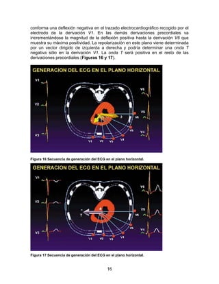 16
conforma una deflexión negativa en el trazado electrocardiográfico recogido por el
electrodo de la derivación V1. En las demás derivaciones precordiales va
incrementándose la magnitud de la deflexión positiva hasta la derivación V6 que
muestra su máxima positividad. La repolarización en este plano viene determinada
por un vector dirigido de izquierda a derecha y podría determinar una onda T
negativa sólo en la derivación V1. La onda T será positiva en el resto de las
derivaciones precordiales (Figuras 16 y 17).
Figura 16 Secuencia de generación del ECG en el plano horizontal.
Figura 17 Secuencia de generación del ECG en el plano horizontal.
 