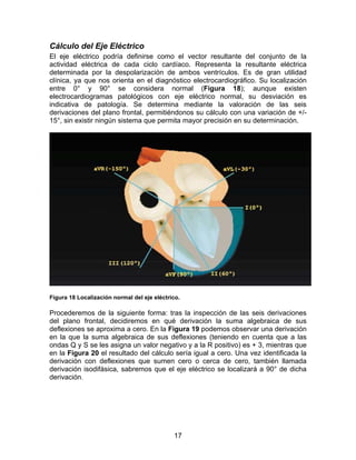 17
Cálculo del Eje Eléctrico
El eje eléctrico podría definirse como el vector resultante del conjunto de la
actividad eléctrica de cada ciclo cardíaco. Representa la resultante eléctrica
determinada por la despolarización de ambos ventrículos. Es de gran utilidad
clínica, ya que nos orienta en el diagnóstico electrocardiográfico. Su localización
entre 0° y 90° se considera normal (Figura 18); aunque existen
electrocardiogramas patológicos con eje eléctrico normal, su desviación es
indicativa de patología. Se determina mediante la valoración de las seis
derivaciones del plano frontal, permitiéndonos su cálculo con una variación de +/-
15°, sin existir ningún sistema que permita mayor precisión en su determinación.
Figura 18 Localización normal del eje eléctrico.
Procederemos de la siguiente forma: tras la inspección de las seis derivaciones
del plano frontal, decidiremos en qué derivación la suma algebraica de sus
deflexiones se aproxima a cero. En la Figura 19 podemos observar una derivación
en la que la suma algebraica de sus deflexiones (teniendo en cuenta que a las
ondas Q y S se les asigna un valor negativo y a la R positivo) es + 3, mientras que
en la Figura 20 el resultado del cálculo sería igual a cero. Una vez identificada la
derivación con deflexiones que sumen cero o cerca de cero, también llamada
derivación isodifásica, sabremos que el eje eléctrico se localizará a 90° de dicha
derivación.
 