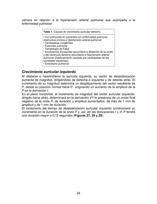 24
cámara en relación a la hipertensión arterial pulmonar que acompaña a la
enfermedad pulmonar.
Tabla 1. Causas de crecimiento auricular derecho
• Cor pulmonale en pacientes con enfermedad pulmonar
obstructiva crónica e hipertensión arterial pulmonar
• Cardiopatías congénitas:
- Estenosis pulmonar
- Tetratología de Fallot
• Insuficiencia tricuspídea secundaria a dilatación de su anillo
y del ventrículo derecho secundaria a hipertensión arterial
pulmonar (habitualmente causada por cardiopatías de las
cavidades izquierdas)
• Embolismo pulmonar
Crecimiento auricular izquierdo
Al dilatarse o hipertrofiarse la aurícula izquierda, su vector de despolarización
aumenta de magnitud, dirigiéndose de derecha a izquierda y de delante atrás. El
incremento de su magnitud determina un desplazamiento del vector resultante de
P, desde su posición normal hacia 0°, originando un aumento de la amplitud de la
P en la derivación I.
En el plano horizontal, el incremento de magnitud del vector auricular izquierdo,
dirigido hacia atrás, determinará en la derivación V1 la presencia de un modo final
negativo de la onda P, de duración y amplitud aumentados, de más de 1 mm de
amplitud y de 1 mm de duración.
El incremento del tiempo de despolarización auricular izquierdo condicionará un
incremento en la duración de la onda P y, así, en las derivaciones I y II, P tendrá
una duración mayor a 0,12 segundos (Figuras 27, 28 y 29).
 