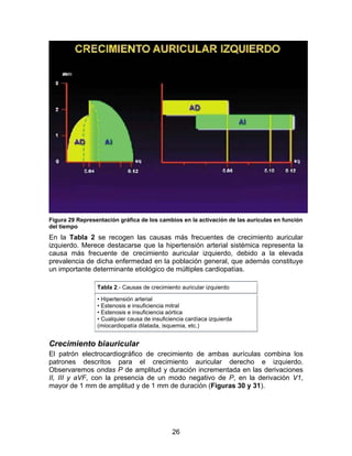 26
Figura 29 Representación gráfica de los cambios en la activación de las aurículas en función
del tiempo
En la Tabla 2 se recogen las causas más frecuentes de crecimiento auricular
izquierdo. Merece destacarse que la hipertensión arterial sistémica representa la
causa más frecuente de crecimiento auricular izquierdo, debido a la elevada
prevalencia de dicha enfermedad en la población general, que además constituye
un importante determinante etiológico de múltiples cardiopatías.
Tabla 2.- Causas de crecimiento auricular izquierdo
• Hipertensión arterial
• Estenosis e insuficiencia mitral
• Estenosis e insuficiencia aórtica
• Cualquier causa de insuficiencia cardíaca izquierda
(miocardiopatía dilatada, isquemia, etc.)
Crecimiento biauricular
El patrón electrocardiográfico de crecimiento de ambas aurículas combina los
patrones descritos para el crecimiento auricular derecho e izquierdo.
Observaremos ondas P de amplitud y duración incrementada en las derivaciones
II, III y aVF, con la presencia de un modo negativo de P, en la derivación V1,
mayor de 1 mm de amplitud y de 1 mm de duración (Figuras 30 y 31).
 
