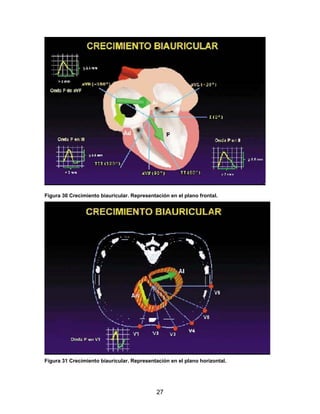 27
Figura 30 Crecimiento biauricular. Representación en el plano frontal.
Figura 31 Crecimiento biauricular. Representación en el plano horizontal.
 