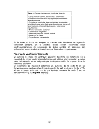 32
Tabla 4.- Causas de hipertrofia ventricular derecha
• Cor pulmonale crónico, secundario a enfermedad
pulmonar obstructiva crónica que provoca hipertensión
arterial pulmonar
• Sobrecarga ventricular derecha debida a hipertensión
arterial pulmonar secundaria a cardiopatías que afectan al
lado izquierdo del corazón (sobretodo a estenosis e
insuficiencia)
• Tromboembolismo pulmonar
• Cardiopatías congénitas:
- Estenosis pulmonar valvular aislada
- Tetralogía de Fallot
- Comunicación interauricular
En la Tabla 4 donde se recogen las causas más frecuentes de hipertrofia
ventricular derecha. En la práctica clínica suelen observarse datos
electrocardiográficos de sobrecarga de dicha cavidad en pacientes con
enfermedad pulmonar obstructiva crónica que desarrollan cor pulmonale.
Hipertrofia ventricular izquierda
El aumento de masa del ventrículo izquierdo determina un incremento en la
magnitud del primer vector (despolarización del tabique interventricular) y, sobre
todo, del segundo vector, originado por la despolarización de la pared libre del
ventrículo izquierdo.
El incremento de magnitud determina un aumento de la onda R en las
derivaciones que exploran el ventrículo izquierdo: I y aVL en el plano frontal y V5 y
V6 en el plano horizontal, por lo que también aumenta la onda S en las
derivaciones V1 y V2 (Figuras 36 y 37).
 
