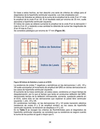 34
En base a estos hechos, se han descrito una serie de criterios de voltaje para el
diagnóstico de la hipertrofia ventricular izquierda. Los más empleados son:
El índice de Sokolow se obtiene de la suma de la amplitud de la onda S en V1 más
la amplitud de la onda R en V6. Si el resultado está por encima de 35 mm, suele
asociarse a hipertrofia ventricular izquierda.
El índice de Lewis se obtiene sumando la amplitud de la onda R en la derivación I
más la S en III, y restando a esa cantidad la obtenida de sumar las magnitudes de
R en III más la S en I.
Se considera patológico por encima de 17 mm (Figura 38).
Figura 38 Índices de Sokolow y Lewis en el ECG.
La existencia de ondas T negativas y asimétricas en las derivaciones I, aVL, V5 y
V6 suele acompañar al incremento de amplitud del QRS en dichas derivaciones en
los casos de hipertrofia ventricular izquierda.
El aumento de la masa ventricular, en estos casos, condiciona un mayor tiempo de
despolarización, por lo que el tiempo que tarda en producirse deflexión del QRS,
denominado tiempo de la deflexión intrinsecoide, aumenta, quedando patente en
el ECG, sobre todo en las derivaciones que exploran la pared libre ventricular
izquierda: I, aVL, V5 y V6.
En condiciones normales, en las derivaciones V3 y V4 existe transición eléctrica
(existencia de ondas R y S de amplitud similar); en los casos de hipertrofia
ventricular izquierda, la transición se desplaza a V1 y V2.
En la Tabla 5 se recogen los criterios de Romhilt-Estes para el diagnóstico de
hipertrofia ventricular izquierda; se considera que su existencia es segura cuando
la suma de los puntos es igual o mayor que 5.
 