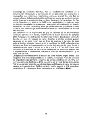 38
sobrecarga de cavidades derechas. Así, es prácticamente constante en la
comunicación interauricular y es frecuente en los pacientes con cardiopatías y
neumopatías que determinen hipertensión pulmonar arterial. En este tipo de
bloqueo, el inicio de la despolarización ventricular es normal, ya que la conducción
se distribuye por la rama izquierda y, por tanto, la génesis de los vectores 1 y 2 es
normal. De este modo, el inicio del QRS es de características normales en todas
las derivaciones del electrocardiograma. La despolarización del ventrículo derecho
se realizará de forma retrasada y lenta, ya que la activación procede de la rama
izquierda y no se distribuye de forma normal desde las ramificaciones de Purkinje
a los miocitos.
Este fenómeno es el responsable de que los vectores de la despolarización
ventricular derecha sean lentos, determinando la mayor duración del complejo
QRS. Aunque pueden distinguirse dos diferentes vectores de activación ventricular
derecha en caso de bloqueo de rama derecha, a efectos prácticos pueden
agruparse en un único vector, que se dirige de izquierda a derecha, de abajo
arriba y de atrás adelante, determinando la morfología del QRS en las diferentes
derivaciones. Este fenómeno condiciona en las derivaciones del plano frontal la
presencia de una onda S ancha en la DI, y una R o R´ en aVR. En el plano
horizontal, la dirección de los vectores de despolarización ventricular derecha será
la responsable de la presencia de una onda R prima en las derivaciones V1 y V2,
y una S en V5 y V6.
La repolarización ventricular en el bloqueo de rama derecha origina ondas T que
se oponen a la deflexión generada por el vector 3. Son ondas T que se oponen a
los empastamientos; por tanto, negativas de ramas asimétricas en V1, V2 y aVR
(y, frecuentemente, también en DIII), y positivas en el resto de las derivaciones.
Podríamos concluir diciendo que el diagnóstico del bloqueo de rama derecha se
basa en la presencia de un QRS de duración igual o superior a 0,12 segundos y
presencia de R´ o secundaria, lenta y empastada, en V1 (Figuras 41-44).
 