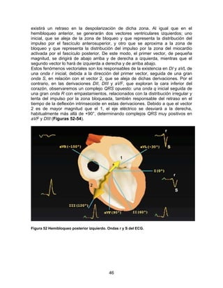 46
existirá un retraso en la despolarización de dicha zona. Al igual que en el
hemibloqueo anterior, se generarán dos vectores ventriculares izquierdos; uno
inicial, que se aleja de la zona de bloqueo y que representa la distribución del
impulso por el fascículo anterosuperior, y otro que se aproxima a la zona de
bloqueo y que representa la distribución del impulso por la zona del miocardio
activada por el fascículo posterior. De este modo, el primer vector, de pequeña
magnitud, se dirigirá de abajo arriba y de derecha a izquierda, mientras que el
segundo vector lo hará de izquierda a derecha y de arriba abajo.
Estos fenómenos vectoriales son los responsables de la existencia en DI y aVL de
una onda r inicial, debida a la dirección del primer vector, seguida de una gran
onda S, en relación con el vector 2, que se aleja de dichas derivaciones. Por el
contrario, en las derivaciones DII, DIII y aVF, que exploran la cara inferior del
corazón, observaremos un complejo QRS opuesto: una onda q inicial seguida de
una gran onda R con empastamientos, relacionados con la distribución irregular y
lenta del impulso por la zona bloqueada, también responsable del retraso en el
tiempo de la deflexión intrinsecoide en estas derivaciones. Debido a que el vector
2 es de mayor magnitud que el 1, el eje eléctrico se desviará a la derecha,
habitualmente más allá de +90°, determinando complejos QRS muy positivos en
aVF y DIII (Figuras 52-54).
Figura 52 Hemibloqueo posterior izquierdo. Ondas r y S del ECG.
 