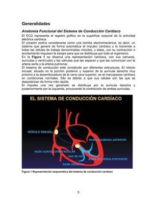 5
Generalidades
Anatomía Funcional del Sistema de Conducción Cardíaco
El ECG representa el registro gráfico en la superficie corporal de la actividad
eléctrica cardíaca.
El corazón podría considerarse como una bomba electromecánica; es decir, un
sistema que genera de forma automática el impulso cardíaco y lo transmite a
todas las células de trabajo denominadas miocitos, y éstas, con su contracción o
acortamiento impulsan la sangre para que se distribuya por todo el organismo.
En la Figura 1 se observa una representación cardíaca, con sus cámaras,
aurículas y ventrículos y las válvulas que las separan y que las comunican con la
arteria aorta y la arteria pulmonar.
El sistema de conducción está constituido por diferentes estructuras. El nódulo
sinusal, situado en la porción posterior y superior de la aurícula derecha muy
próximo a la desembocadura de la vena cava superior, es el marcapasos cardíaco
en condiciones normales. Ello es debido a que sus células son las que se
despolarizan de forma más rápida.
El impulso una vez generado se distribuye por la aurícula derecha y
posteriormente por la izquierda, provocando la contracción de ambas aurículas.
Figura 1 Representación esquemática del sistema de conducción cardíaco
 