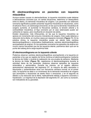 63
El electrocardiograma en pacientes con isquemia
miocárdica
Aunque existen causas no ateroscleróticas, la isquemia miocárdica suele deberse
a aterosclerosis coronaria que, en ciertas situaciones, determina un desequilibrio
entre la oferta y la demanda miocárdica de oxígeno. Los pacientes con estenosis
coronaria significativa pueden presentar isquemia miocárdica en situaciones, como
el esfuerzo físico y la sobrecarga emocional, en las que la demanda miocárdica de
oxígeno aumenta, al aumentar la frecuencia cardíaca, la tensión arterial y la
contractilidad miocárdica; el flujo coronario por el vaso estenosado puede ser
suficiente en reposo, pero insuficiente en situación de estrés.
Existen situaciones, más infrecuentes, en las que la isquemia miocárdica se
aprecia sin incremento del consumo miocárdico de oxígeno. Esto suele deberse a
reducción de la oferta, en muchos casos por espasmo coronario (Figura 75). En la
práctica clínica, la isquemia miocárdica puede ser silente (sólo cambios
electrocardiográficos) o sintomática (habitualmente, cambios electrocardiográficos
acompañados de angina). En los pacientes coronarios los episodios de angina son
mucho menos frecuentes que los de isquemia silente; podríamos decir que son la
punta del iceberg de la carga isquémica total.
El electrocardiograma en la isquemia silente
Podemos observar cambios electrocardiográficos acompañando a la isquemia en
pacientes a los que se registra de forma continua el electrocardiograma mediante
la técnica de Holter o durante la realización de una prueba de esfuerzo. Mediante
la técnica de Holter (Figura 76), registramos el electrocardiograma durante la
actividad diaria de los pacientes; podemos observar episodios de isquemia
sintomática y asintomática. Durante los mismos, en el registro eléctrico
apreciaremos depresiones del segmento ST, la mayoría de ellos asociados a
taquicardia y presentándose otros con frecuencia cardíaca normal; en el primer
caso, la isquemia se debe a un incremento de la demanda miocárdica de oxígeno
que acompaña a situaciones de estrés físico o emocional, y en el segundo es
debido a una reducción de la oferta, habitualmente debida a espasmo coronario o
hipotensión. La magnitud de la depresión del segmento ST, así como su duración,
son indicadores de su gravedad.
 