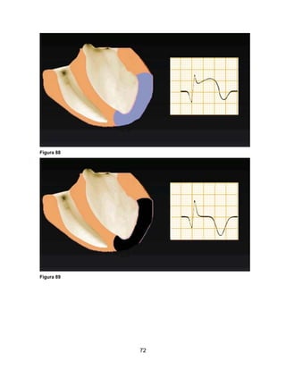 72
Figura 88
Figura 89
 