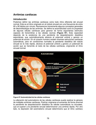 78
Arritmias cardíacas
Introducción
Podemos definir las arritmias cardíacas como todo ritmo diferente del sinusal
normal. Este es el ritmo originado en el nódulo sinusal con una frecuencia de entre
60 y 90 latidos por minuto. Revisaremos brevemente algunos conceptos generales
de electrofisiología de las arritmias. Se define la automaticidad como la propiedad
de algunas células cardíacas para generar de forma espontánea estímulos
capaces de transmitirse a las células vecinas (Figura 97). Esta capacidad
depende de la existencia de una pendiente de despolarización diastólica
espontánea, que automáticamente alcanza el potencial umbral y genera un
potencial de acción. En el corazón humano existen diversas estructuras cardíacas
automáticas, pero en condiciones normales la pendiente diastólica del nódulo
sinusal es la más rápida, alcanza el potencial umbral y genera un potencial de
acción que se transmite al resto de las células cardíacas, originando el ritmo
sinusal normal.
Figura 97 Automaticidad de las células cardíacas
La alteración del automatismo de las células cardíacas puede explicar la génesis
de múltiples arritmias cardíacas. Podrían originarse al aumentar de forma anormal
la pendiente de despolarización diastólica de células automáticas no sinusales,
que al superar a la pendiente sinusal determinarían una arritmia rápida. Por otro
lado, la depresión del automatismo sinusal determinaría que el ritmo cardíaco
 