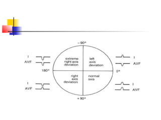 Simple Approach Ecg ECG made easy PART 1 | PPT