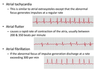 • Atrial tachycardia
– This is similar to atrial extrasystoles except that the abnormal
focus generates impulses at a regular rate
• Atrial flutter
– causes a rapid rate of contraction of the atria, usually between
200 & 350 beats per minute
• Atrial fibrillation
– If the abnormal focus of impulse generation discharge at a rate
exceeding 300 per min
 