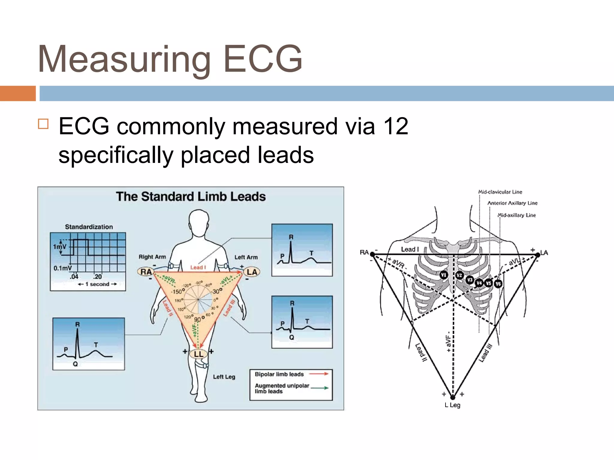 Measuring ECG


ECG commonly measured via 12
specifically placed leads

 
