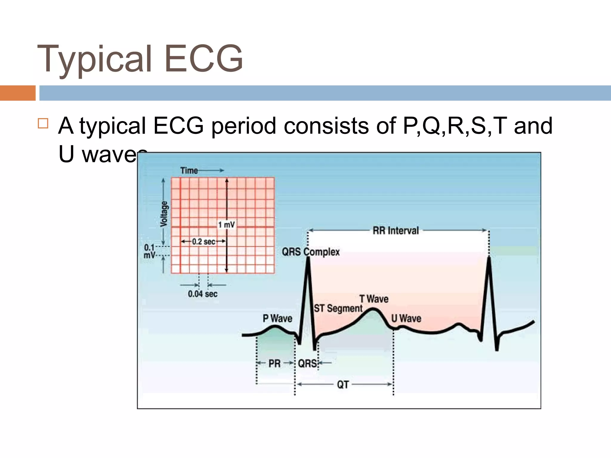 Typical ECG


A typical ECG period consists of P,Q,R,S,T and
U waves

 