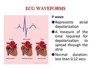 ECG WAVEFORMS
P wave
Represents atrial
depolarization
A measure of the
time required for
depolarization to
spread through the
atria
Normal duration:
less than 0.12 secs
 