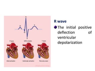 R wave
The initial positive
deflection of
ventricular
depolarization
 