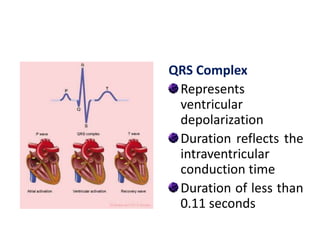 QRS Complex
Represents
ventricular
depolarization
Duration reflects the
intraventricular
conduction time
Duration of less than
0.11 seconds
 