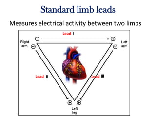 Standard limb leads
Measures electrical activity between two limbs
Lead
LeadLead
 