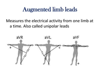 Augmented limb leads
Measures the electrical activity from one limb at
a time. Also called unipolar leads
 