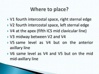  V1 fourth intercostal space, right sternal edge
 V2 fourth intercostal space, left sternal edge
 V4 at the apex (fifth ICS mid clavicular line)
 V3 midway between V2 and V4
 V5 same level as V4 but on the anterior
axillary line
 V6 same level as V4 and V5 but on the mid
mid-axillary line
 