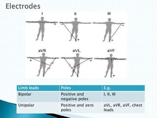 Limb leads Poles E.g.
Bipolar Positive and
negative poles
I, II, III
Unipolar Positive and zero
poles
aVL, aVR, aVF, chest
leads
 