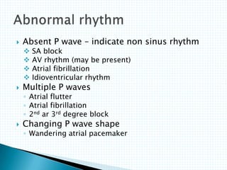  Absent P wave – indicate non sinus rhythm
 SA block
 AV rhythm (may be present)
 Atrial fibrillation
 Idioventricular rhythm
 Multiple P waves
◦ Atrial flutter
◦ Atrial fibrillation
◦ 2nd ar 3rd degree block
 Changing P wave shape
◦ Wandering atrial pacemaker
 