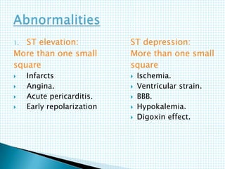 1. ST elevation:
More than one small
square
 Infarcts
 Angina.
 Acute pericarditis.
 Early repolarization
ST depression:
More than one small
square
 Ischemia.
 Ventricular strain.
 BBB.
 Hypokalemia.
 Digoxin effect.
 