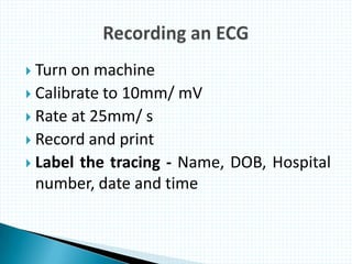  Turn on machine
 Calibrate to 10mm/ mV
 Rate at 25mm/ s
 Record and print
 Label the tracing - Name, DOB, Hospital
number, date and time
 