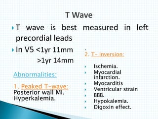  T wave is best measured in left
precordial leads
 In V5 <1yr 11mm
>1yr 14mm
Abnormalities:
1. Peaked T-wave:
Posterior wall MI.
Hyperkalemia.
.
2. T- inversion:
 Ischemia.
 Myocardial
infarction.
 Myocarditis
 Ventricular strain
 BBB.
 Hypokalemia.
 Digoxin effect.
 