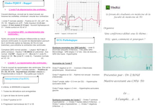 : L’onde P de dépolarisation des oreillettes :
Courant électrique, envoyé par le nœud sinusal, qui
traverse les oreillettes, entrainant ensuite leur contraction.
L’onde P normale (adulte): - Positive en D1, D2, aVF, V4,
V5, V6 - Négative en aVR - Taille (hauteur) ≤ 2.5 mm -
Largeur <3 mm (soient 0.12 sec) - Souvent biphasique en
V1 - Visible surtout en D2 et V1
 Le complexe QRS : La dépolarisation des
ventricules :
Après une pause de quelques millisecondes au nœud
auriculo-ventriculaire, le courant de dépolarisation parcourt
les 2 ventricules (grâce au faisceau de His et à ses
branches), puis entraîne la contraction des ventricules.
Complexe QRS normal (adulte) : - Largeur <0,11 sec (3
petits carreaux) - Hauteur < 25-30mm en précordial - Axe
normal : 0 à+90° - Aspect en V1 : rS(onde S > onde R) -
Aspect en V6 : Rs (onde R > onde S) - Transition normale
en V3, V4 (4)
 L’onde T : La repolarisation des ventricules :
C’est le courant de repolarisation des ventricules. Elle suit le
complexe QRS. Onde T normale (adulte) : - Positive en
D1, D2, V4 à V6 - Asymétrique (montée « douce ») -
Proportionnelle à l’onde R - Plus petite que l’onde R
4 critères, le MINIMUM à respecter
1. Toutes les dérivations sont enregistrées
2. Ligne de base de bonne qualité
3. Onde P positive en D1
4. Progression harmonieuse de V1 à V6
Quelques anomalies des QRS (adulte) : - onde Q
anormale (séquelle d’infarctus) - Très petits QRS :
Microvoltage - QRS larges (> 0,12s) : bloc de branche … -
QRS très hauts : Hypertrophie
Anomalies de l’onde P
Onde P négative en D1 : - Inversion d’électrodes
périphériques - Situsinversus
Onde P négative en D2 : - Rythme non sinusal - Inversion
d’électrodes
Onde P ample, taille > 2.5 mm (en D2) : - Hypertrophie
auriculaire droite
Onde P large, largeur ≥ 3 mm : - Hypertrophie auriculaire
gauche.
Quelques anomalies de l’onde T : - Ondes T pointues
(hyperkaliémie …) - Ondes T hautes (début d’infarctus …) -
Ondes T plates (hypokaliémie …) - Ondes T négatives
(infarctus …)
Le forum des étudiants en médecine de la
faculté de médecine de TO
Organise
Une conférence-débat sous le thème :
ECG : quoi, comment et pourquoi ?
Présentée par : Dr ZAOUI
Maitre-assistant au CHU- TO
Le …
À l’amphi… à … h
Ondes PQRST : Rappel
Interprétation d’un ECG
ECG Pathologique
 