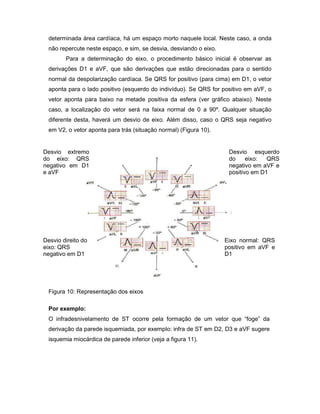 determinada área cardíaca, há um espaço morto naquele local. Neste caso, a onda
não repercute neste espaço, e sim, se desvia, desviando o eixo.
Para a determinação do eixo, o procedimento básico inicial é observar as
derivações D1 e aVF, que são derivações que estão direcionadas para o sentido
normal da despolarização cardíaca. Se QRS for positivo (para cima) em D1, o vetor
aponta para o lado positivo (esquerdo do indivíduo). Se QRS for positivo em aVF, o
vetor aponta para baixo na metade positiva da esfera (ver gráfico abaixo). Neste
caso, a localização do vetor será na faixa normal de 0 a 90º. Qualquer situação
diferente desta, haverá um desvio de eixo. Além disso, caso o QRS seja negativo
em V2, o vetor aponta para trás (situação normal) (Figura 10).
Figura 10: Representação dos eixos
Por exemplo:
O infradesnivelamento de ST ocorre pela formação de um vetor que “foge” da
derivação da parede isquemiada, por exemplo: infra de ST em D2, D3 e aVF sugere
isquemia miocárdica de parede inferior (veja a figura 11).
Desvio esquerdo
do eixo: QRS
negativo em aVF e
positivo em D1
Eixo normal: QRS
positivo em aVF e
D1
Desvio extremo
do eixo: QRS
negativo em D1
e aVF
Desvio direito do
eixo: QRS
negativo em D1
 