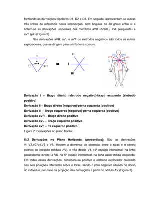 formando as derivações bipolares D1, D2 e D3. Em seguida, acrescentam-se outras
três linhas de referência nesta intersecção, com ângulos de 30 graus entre si e
obtém-se as derivações unipolares dos membros aVR (direita), aVL (esquerda) e
aVF (pé) (Figura 2).
Nas derivações aVR, aVL e aVF os eletrodos negativos são todos os outros
exploradores, que se dirigem para um fio terra comum.
Derivação I – Braço direito (eletrodo negativo)-braço esquerdo (eletrodo
positivo)
Derivação II – Braço direito (negativo)-perna esquerda (positivo)
Derivação III – Braço esquerdo (negativo)-perna esquerda (positivo)
Derivação aVR – Braço direito positivo
Derivação aVL – Braço esquerdo positivo
Derivação aVF – Pé esquerdo positivo
Figura 2: Derivações no plano frontal.
III.2 Derivações no Plano Horizontal (precordiais): São as derivações
V1,V2,V3,V4,V5 e V6. Medem a diferença de potencial entre o tórax e o centro
elétrico do coração (nódulo AV), e vão desde V1, (4º espaço intercostal, na linha
paraesternal direita) a V6, no 5º espaço intercostal, na linha axilar média esquerda.
Em todas essas derivações, considera-se positivo o eletrodo explorador colocado
nas seis posições diferentes sobre o tórax, sendo o pólo negativo situado no dorso
do indivíduo, por meio da projeção das derivações a partir do nódulo AV (Figura 3).
DI
DIIIDII
aVF
aVLaVR
•
I
II III = I
II
III
 
