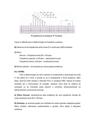 Figura 4: Método para a determinação da freqüência cardíaca.
B) Observar se há freqüências atrial (onda P) e ventricular (QRS) distintas;
C) Ritmo
Normal – Freqüência entre 60 e 100 bpm
Freqüência superior a 100 bpm – taquicardia sinusal;
Freqüência inferior a 60 bpm – bradicardia sinusal;
D) Ritmos próprios – provocados por marca-passos ectópicos.
IV.2. RITMO
Para a determinação do ritmo cardíaco é fundamental a observação da onda
P. Ela define se o ritmo é sinusal ou se é conseqüente a focos ectópicos. Além
disso, deve-se medir sempre o intervalo P-R e o complexo QRS. Apesar do nódulo
sinoatrial ser o marca-passo do coração, qualquer outra área do sistema de
condução ou do miocárdio pode assumir o comando, temporariamente ou
definitivamente, provocando arritmias.
A) Ritmo Sinusal: caracteriza-se pela existência de uma seqüência ritmada de
ciclos cardíacos entre 60 e 100 bpm.
B) Arritmias: as arritmias podem ser divididas em quatro grandes categorias gerais:
Ritmo variável, batimentos suplementares e pausas, ritmo rápido e bloqueios
cardíacos.
 