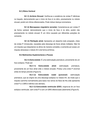 B.1) Ritmo Variável
B.1.1) Arritmia Sinusal: Verifica-se a existência de ondas P idênticas
no traçado, demonstrando que o inicio do foco é no átrio, precisamente no nódulo
sinusal, porém em ritmos diferenciados. Pode indicar doença coronariana.
B.1.2) Marcapasso migratório (errante): Caracteriza-se por ondas P
de forma variável, demonstrando que o início do foco é no átrio, porém não
precisamente no nódulo sinusal. É um ritmo causado por diferentes posições do
comando.
B.1.3) Fibrilação atrial: Apresenta um desenho todo arrepiado, cheio
de ondas P minúsculas, causadas pela descarga de focos atriais múltiplos. Não há
um impulso que despolarize os átrios de maneira completa, e somente por acaso um
impulso atravessa o nódulo AV e de forma arrítmica.
B.2 Batimentos Suplementares e Pausas
B.2.1) Extra-sístole: É uma estimulação prematura, proveniente de um
foco ectópico. Pode ser:
B.2.1.1) Extra-sístole atrial: estimulação prematura,
proveniente de um foco atrial (não o nódulo sinusal). Produz uma onda P anormal
antes do tempo previsto (Figura 5).
B.2.1.2) Extra-sístole nodal (juncional): estimulação
prematura, que se origina de uma descarga ectópica no nódulo AV, de modo que o
impulso caminha normalmente para baixo nos ramos do feixe de His (não apresenta
onda P e o QRS é idêntico aos demais).
B.2.1.3) Extra-sístole ventricular (ESV): origina-se de um foco
ectópico ventricular, sem onda P e com um QRS diferenciado (aberrante) (Figura 6).
 