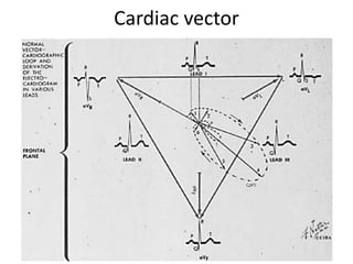Ecg | PPSX