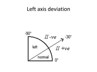 Ecg | PPSX