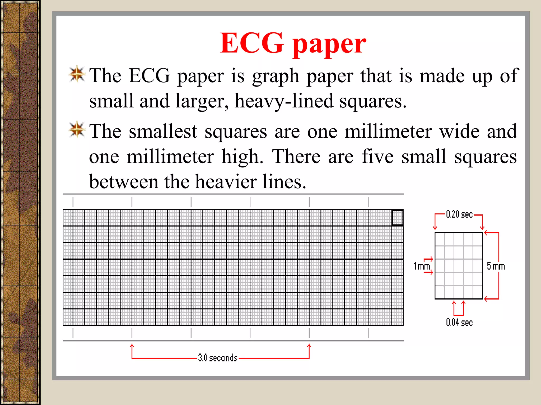 ECG paper
The ECG paper is graph paper that is made up of
small and larger, heavy-lined squares.
The smallest squares are one millimeter wide and
one millimeter high. There are five small squares
between the heavier lines.
 