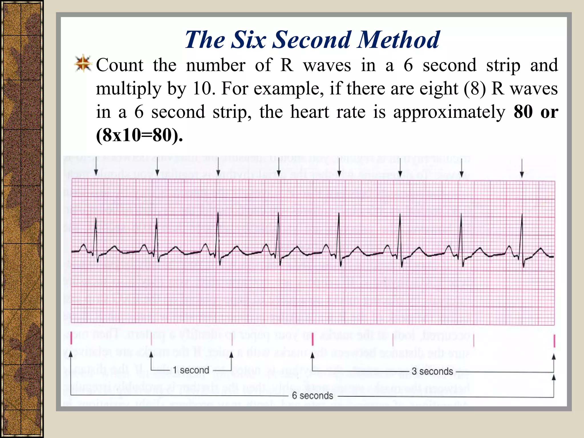 Ecg for Nurses... | PPT