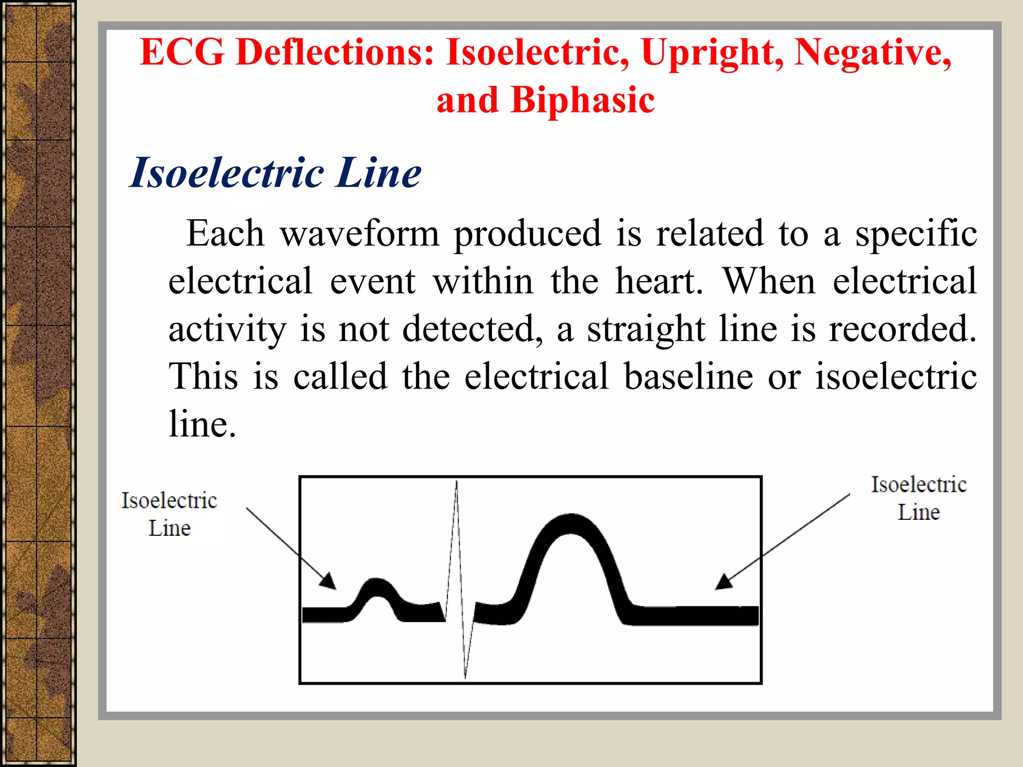 ECG Deflections: Isoelectric, Upright, Negative,
and Biphasic
Isoelectric Line
Each waveform produced is related to a specific
electrical event within the heart. When electrical
activity is not detected, a straight line is recorded.
This is called the electrical baseline or isoelectric
line.
 